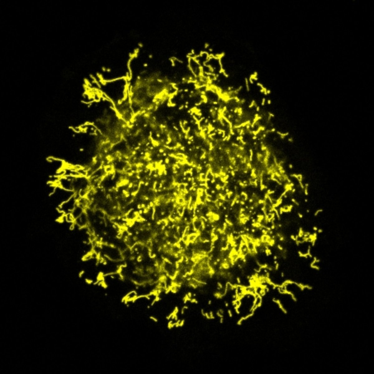 JeffMewburn's tweet photo. Starburst Mitochondria! Having fun #archerlab @queensuResearch @DrStephenArcher @Asish_Dasgupta https://t.co/lDKpi9To6M