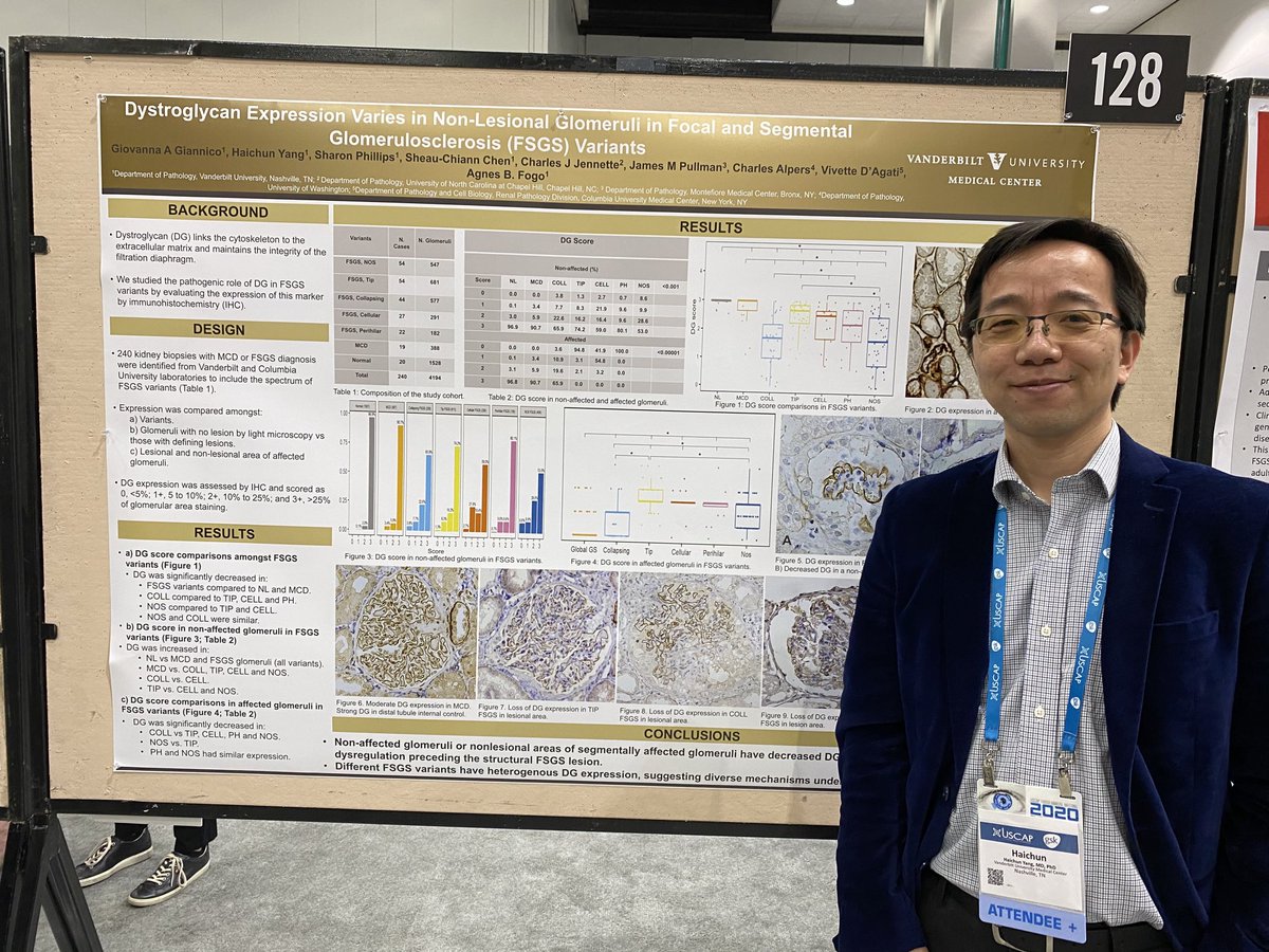AgnesFogo's tweet image. Haichun Yan’s presenting on behalf of Giovanna Giannico our work on dystroglycan in FSGS variants at USCAO # renalpath # Vanderbilt kidney