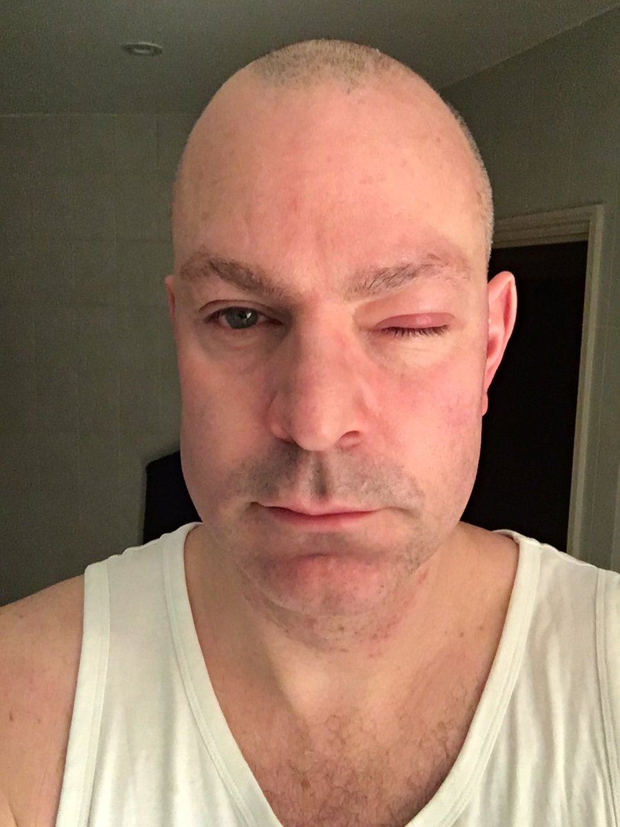 TeacherToolkit's tweet image. Left:

One month before an Ofsted inspection...

Right:

One month after an Ofsted inspection...

📲 teachertoolkit.co.uk/2018/04/29/lif… #OfstedReform #SLTchat #MentalHealth #FlexibleWorking #StuckSchools  

Who looks after you before it’s too late?