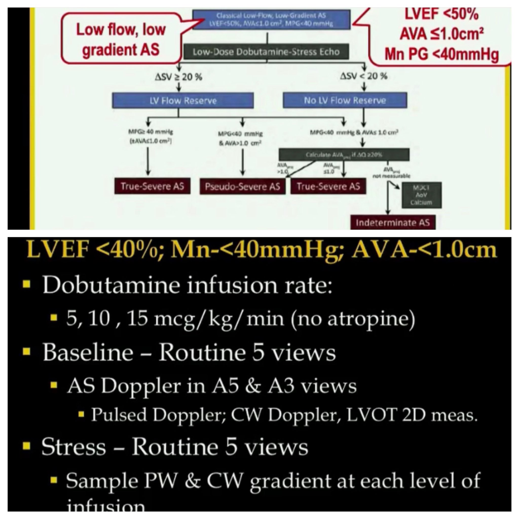 Ritu Thamman MD on Twitter "Dobutamine stress echo for low flow low