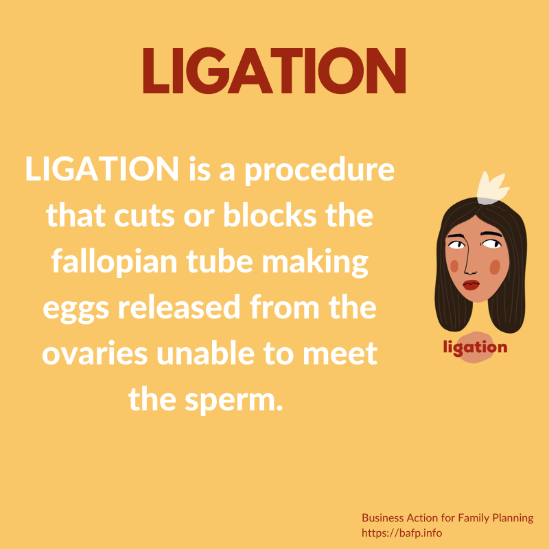 rhcareinfo's tweet image. Ligation is a permanent family planning method for women. Got questions? Learn all about it at bafp.info/ligation/ #ligation #bafp2020 #familyplanning #birthcontrol