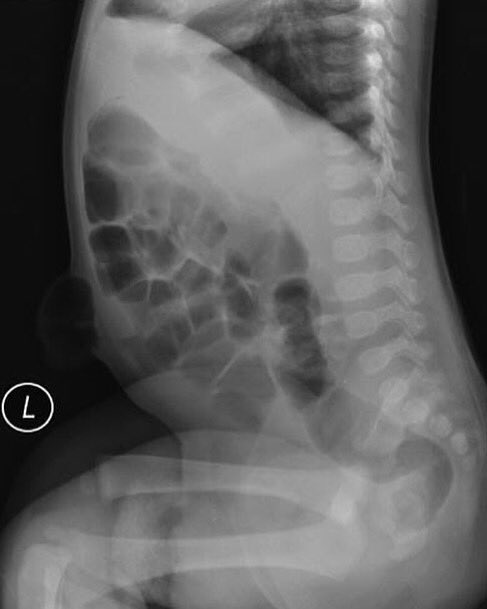 GoodDoctor18's tweet photo. What does this radiograph show? Can you interpret it?

#Covid_19 #medical_student #فضفضة_طالب_طب #فضفضة_طبيب #لست_وحدك https://t.co/YBGB2vkYOF