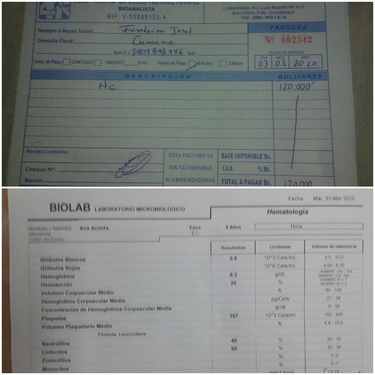 fundacionjesed's tweet photo. Gracias a @ALV457 por pagar hematología de nuestra princesa Ana Acosta dx #neuroblastoma sus valores salieron muy bajos por lo cuál se le indicó transfusión de sangre, en vista que no mejoró con el 2do protocolo la Dra indica un nuevo tratamiento. Pedimos a Dios por su salud🙏 https://t.co/Kign9nY3DD