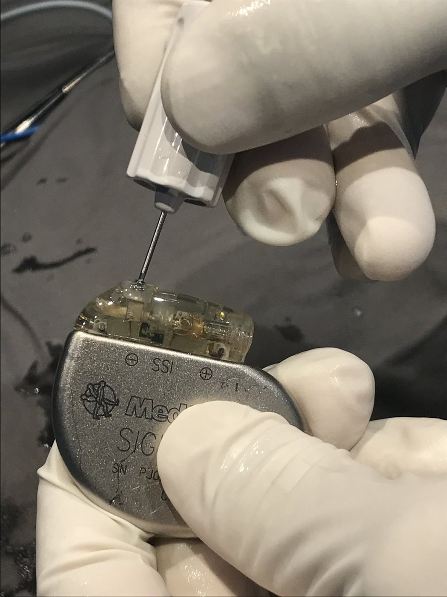 UlhasDr's tweet photo. When wrench disengages setscrew from connector port! @SchakrabartiEP @narrowQRS @rdschaller @ecgrhythms @ecgguru @drnjy @SuchitMajumder @DCR_Dr @Vadeboncoeur_Al @Hapa_EP @PaymardM @chaturvedimd @Epeeps_Bot @KakkamKrishna @AparnaBalaji4 https://t.co/1lh1XWRWEW