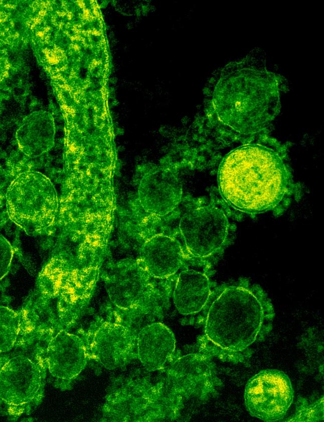 covid_virus's tweet photo. #coronavirus #COVID19
More electron microscopy images of Novelcoronavirus taken by Rocky Mountain Laboratories and other research facilities. It's amazing how these 0.1 micron sized protein and nucleic acid particles can ruin such damage. https://t.co/zwZXe4QtZB