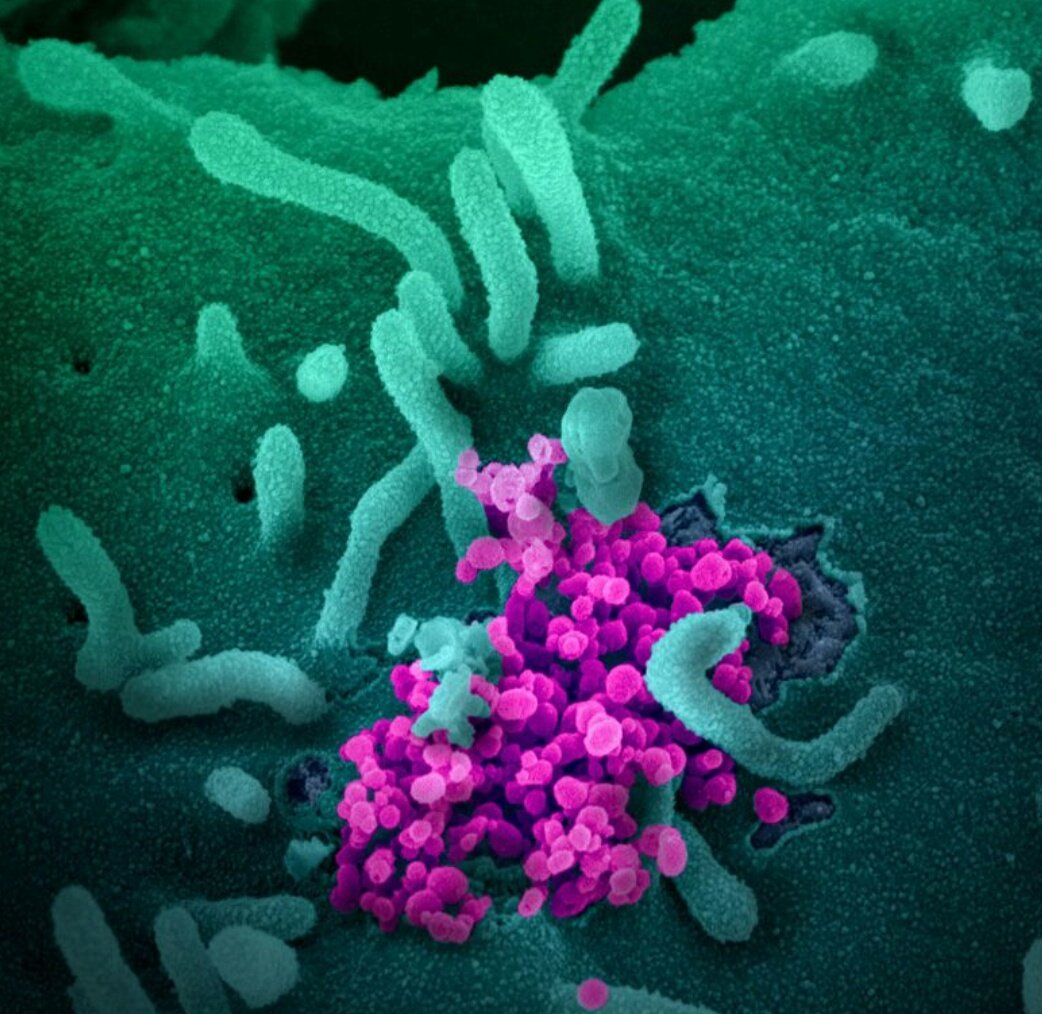 covid_virus's tweet photo. #coronavirus #COVID19
More electron microscopy images of Novelcoronavirus taken by Rocky Mountain Laboratories and other research facilities. It's amazing how these 0.1 micron sized protein and nucleic acid particles can ruin such damage. https://t.co/zwZXe4QtZB