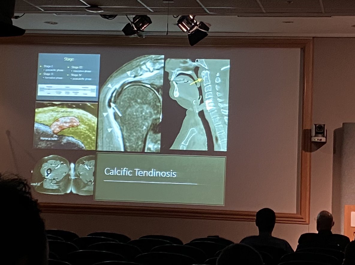 angiowoman's tweet photo. @EmoryRadiology presents #MSKinterventions fr the amazing Dr Felix Gonzalez. Fighting pain & opioid addiction with #nerveinjection #nerveablation #Partnership with @EmoryIRad @NimaKokabiMD @ZachBercuMD @jdprologo @AngieKramer1 https://t.co/Ws91Jmq6Rn
