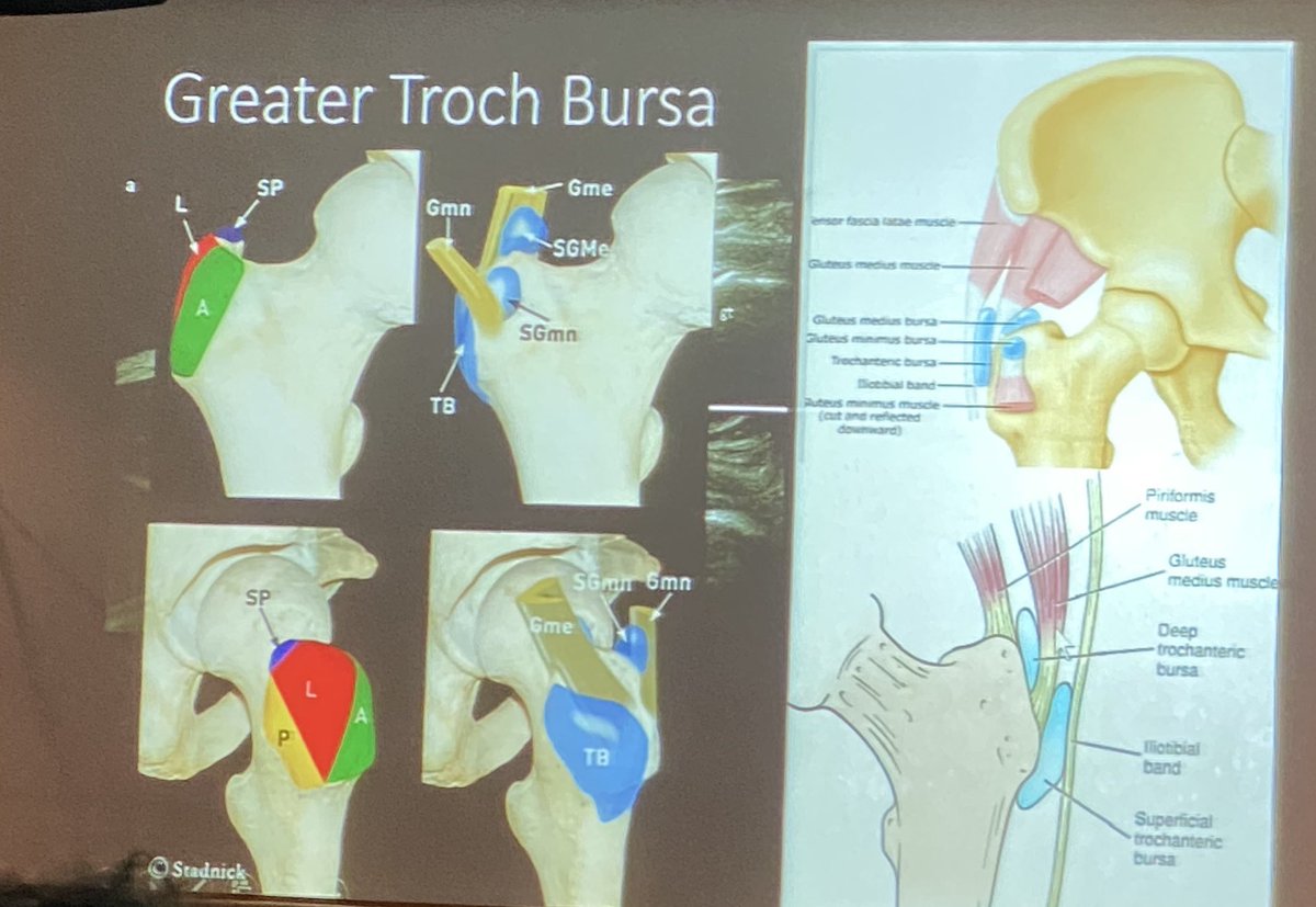 angiowoman's tweet photo. @EmoryRadiology presents #MSKinterventions fr the amazing Dr Felix Gonzalez. Fighting pain & opioid addiction with #nerveinjection #nerveablation #Partnership with @EmoryIRad @NimaKokabiMD @ZachBercuMD @jdprologo @AngieKramer1 https://t.co/Ws91Jmq6Rn