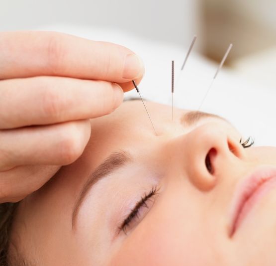 Naturna_Life's tweet photo. Did you know that acupuncture is generally recognized as safe during pregnancy, a time where most oral drugs are better avoided. Most patients using acupuncture report that they improve when they are treated but migraines come back if they stop the treatments. https://t.co/KkouUIu2nC