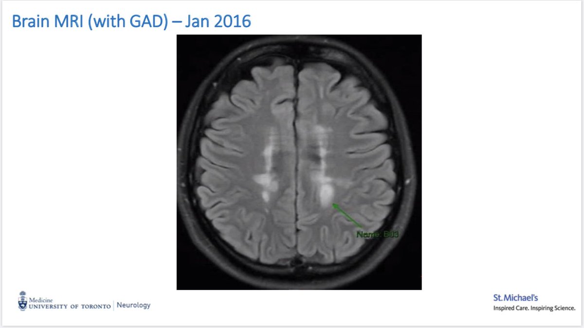 DanOntaneda's tweet photo. Excellent cases as always... seems we continue to find interesting cases. The discussion as always the highlight! #MSMRI @JeffCohenMD @XMontalban @J_SastreGarriga @JennyFengMD @cemcat_em @UofTNeurology @ClevelandClinic https://t.co/9JzGOXpC3E