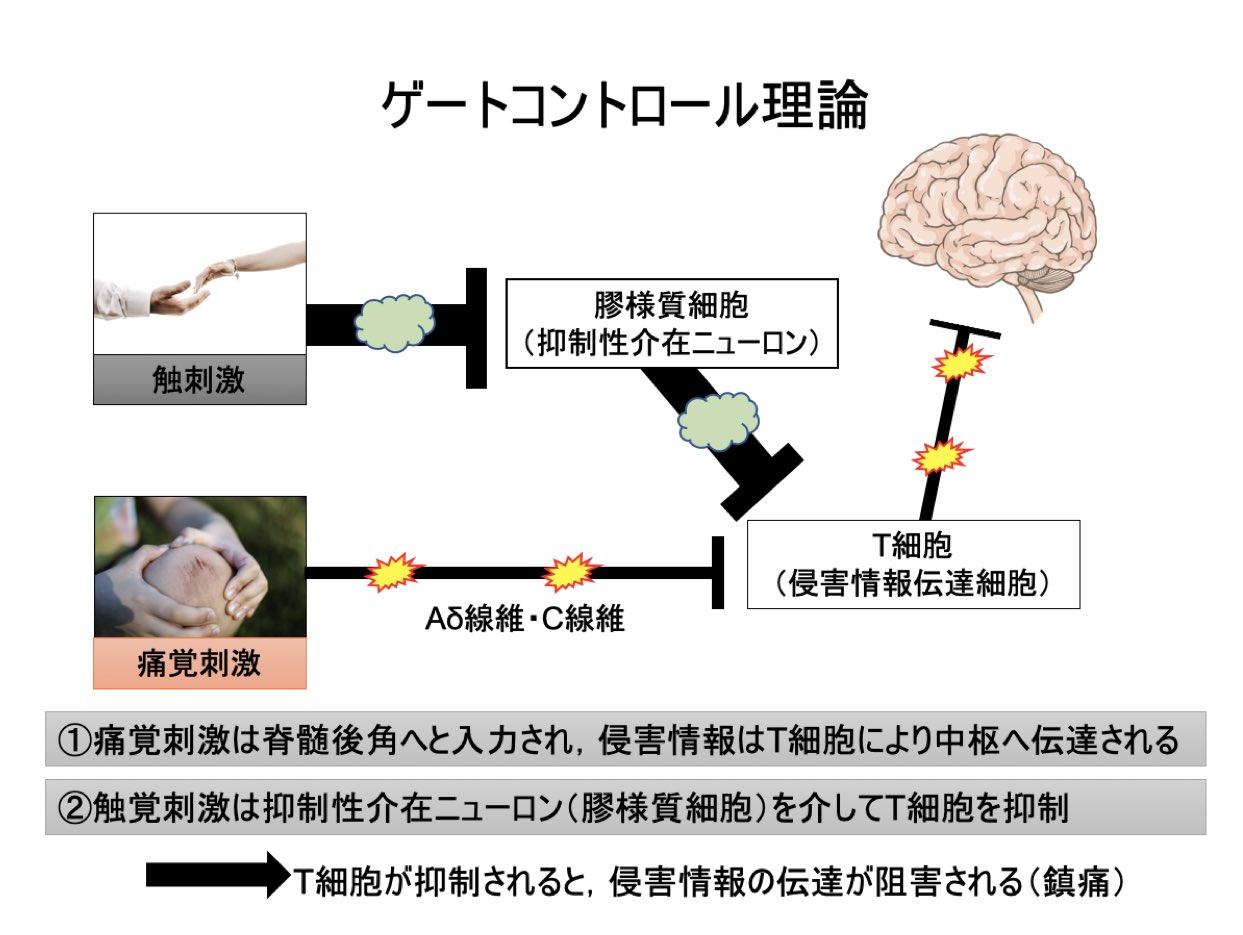 物理療法pt Twitterissa ゲートコントロール理論 簡略 Https T Co Xzn1irckkh Twitter