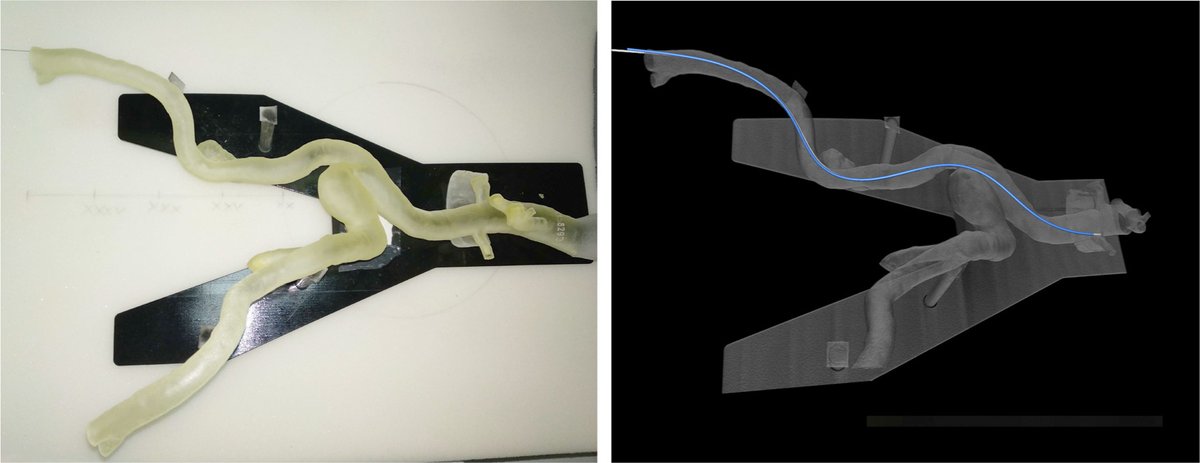 FraunhoferMEVIS's tweet photo. Fiber optical shape sensing for endovascular navigation: Find out more on our poster at @BVM_workshop 2020 in #Berlin: https://t.co/L616creC1a #fiberoptics #endovascular #navigation #BVM2020 https://t.co/jTmplOQqqc