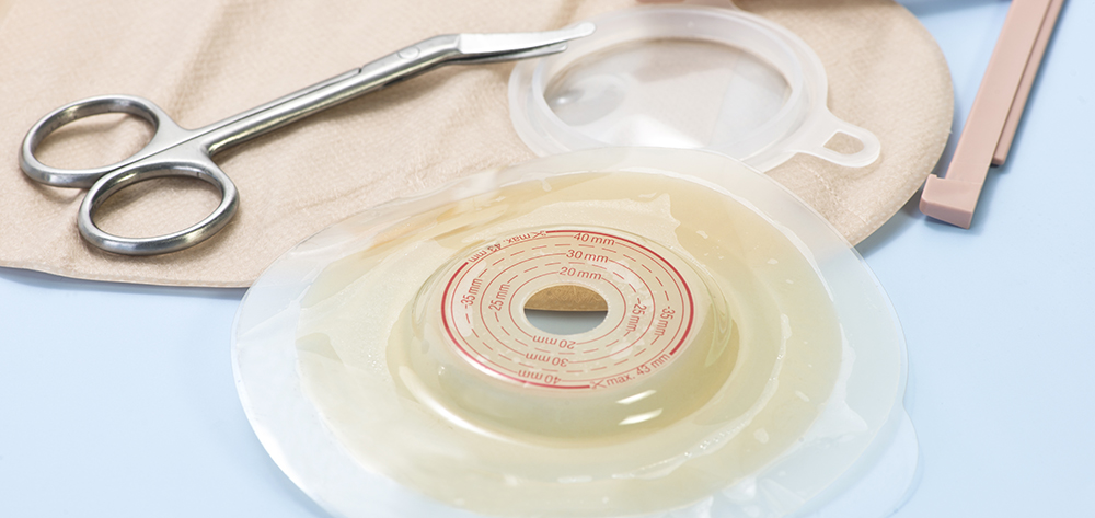Moldable #ostomy barrier rings and strips ht.ly/ndZ730qn1du 
A new tool you can apply in your daily practice - here’s a brief overview on moldable, bendable, and stretchable adhesive rings and strips used to improve the seal around a #stoma. 
#woundcare #HCM