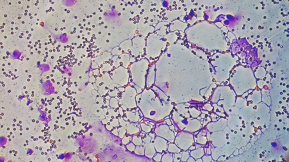 BreeJodee's tweet photo. Když už jsme u té Histologie, tak něco málo z preparátků: 1) obtiskový preparát - plíce, 2) řezový - jazyk, 3 a 4) střevo :-) https://t.co/udrZzSeIBH