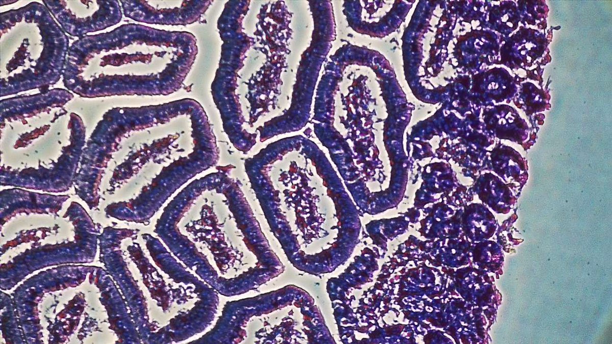 BreeJodee's tweet photo. Když už jsme u té Histologie, tak něco málo z preparátků: 1) obtiskový preparát - plíce, 2) řezový - jazyk, 3 a 4) střevo :-) https://t.co/udrZzSeIBH