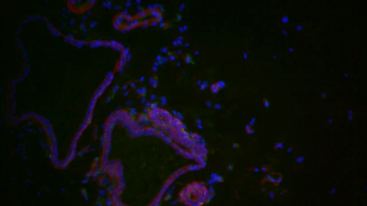 BreeJodee's tweet photo. Po dlouhé době opět něco malinko ze života :-P
- na obrázku je fluorescenčně obarvený řez mléčnou žlázou - modře jádra (DAPI),červeně aktin, zeleně MHC. https://t.co/kiObf4Sda7
