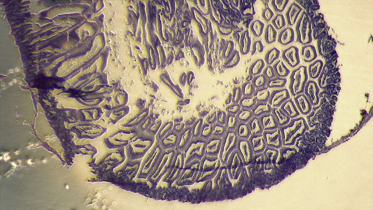 BreeJodee's tweet photo. Když už jsme u té Histologie, tak něco málo z preparátků: 1) obtiskový preparát - plíce, 2) řezový - jazyk, 3 a 4) střevo :-) https://t.co/udrZzSeIBH