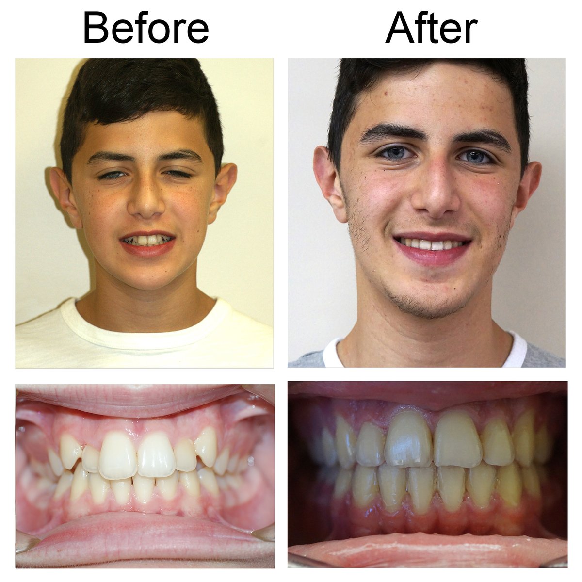 Regal Orthodontics (@RegalOrtho) / Posts / X