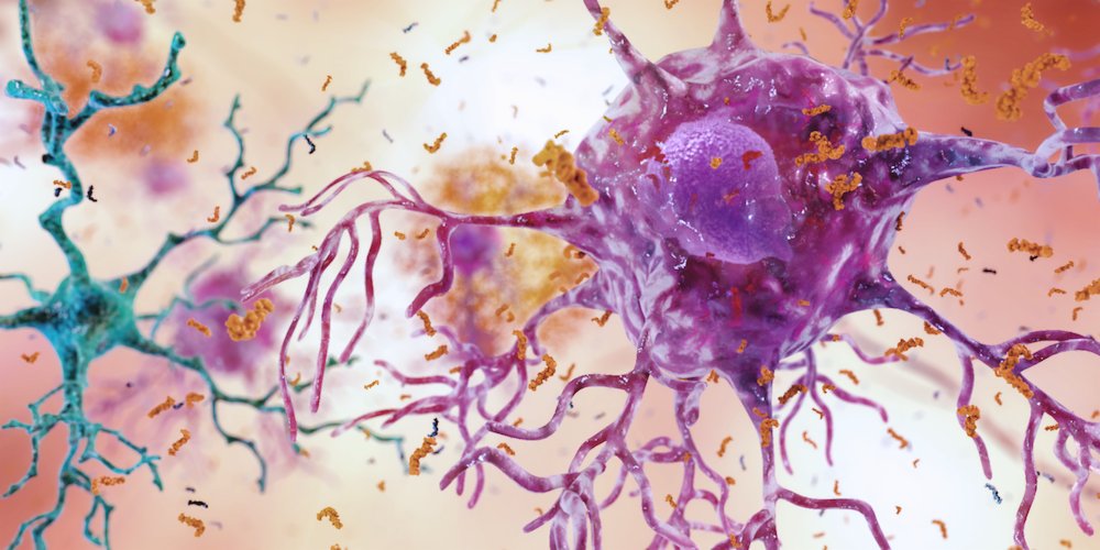 UKDRI's tweet photo. Glial Cells: Identities, functions & roles in brain health & disease🌟
Co-organised by @EdNiBL, this course introduces astrocytes, oligodendrocytes & microglia - from basics to latest knowledge on function
📍Glasgow 🗓️10 July - pre #FENS2020
➡️https://t.co/LlXf5ZIpxj https://t.co/U1BhOmAbst