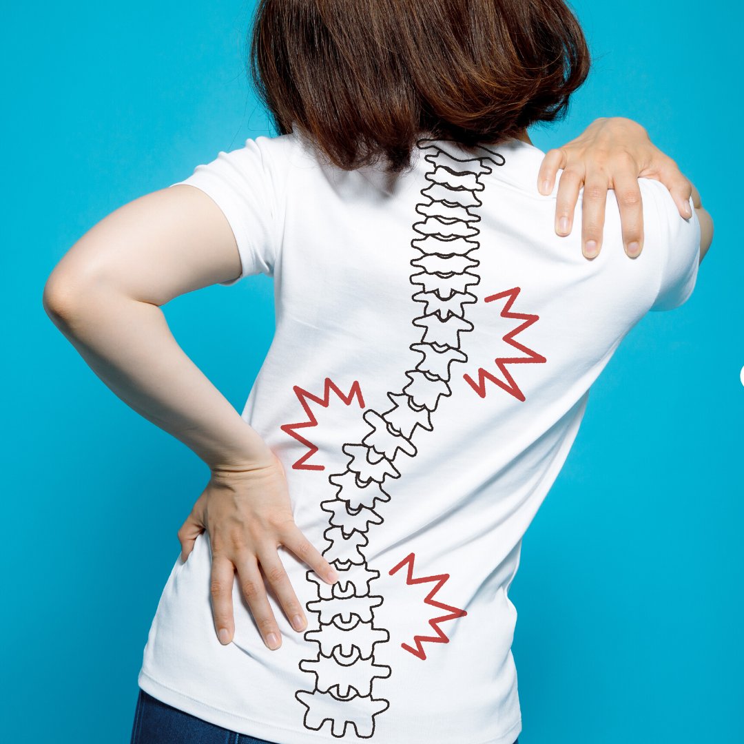 Nimbleback's tweet photo. Anyone else feel like this today? 😫  Stand up straight 😊 #hunched #badposture https://t.co/XxJVu8xMRa