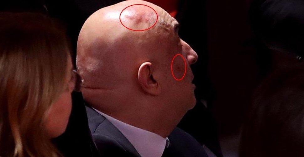 Türkiye, rejim unsurlarına ağır darbeler vurmaya devam ediyor.

#HainsinEnginÖzkoç