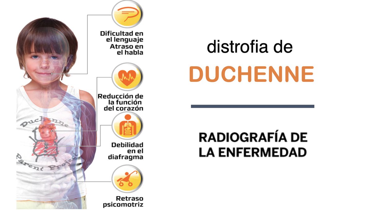 pfizer_spain's tweet photo. "Para que se investigue una enfermedad necesitas darle visibilidad, y esa visibilidad requiere inversión". @savilaram40, pta. de @DPPSpain, explica en @larazon_es el dilema de muchas asociaciones de pacientes de #EnfermedadesRaras https://t.co/74ZQKmppuF 

#Duchenne @NoInvisibles https://t.co/Z04OjoIQps