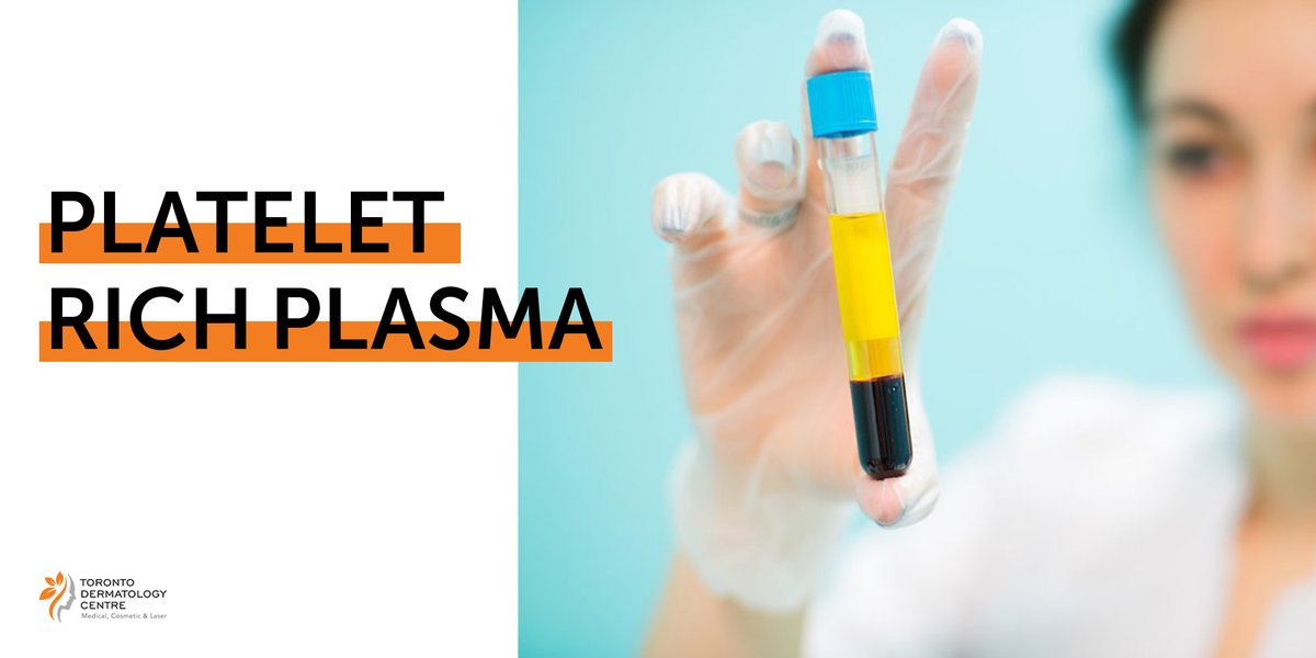 DermatologyTDC's tweet photo. Platelet Rich Plasma (PRP) has shown benefit for injection for osteoarthritis of the joints. As well, research shows numerous anti-aging benefits for the face and neck. PRP injected into the scalp has shown a good response in halting hair loss and producing good hair growth. https://t.co/rj4RNbQXAc