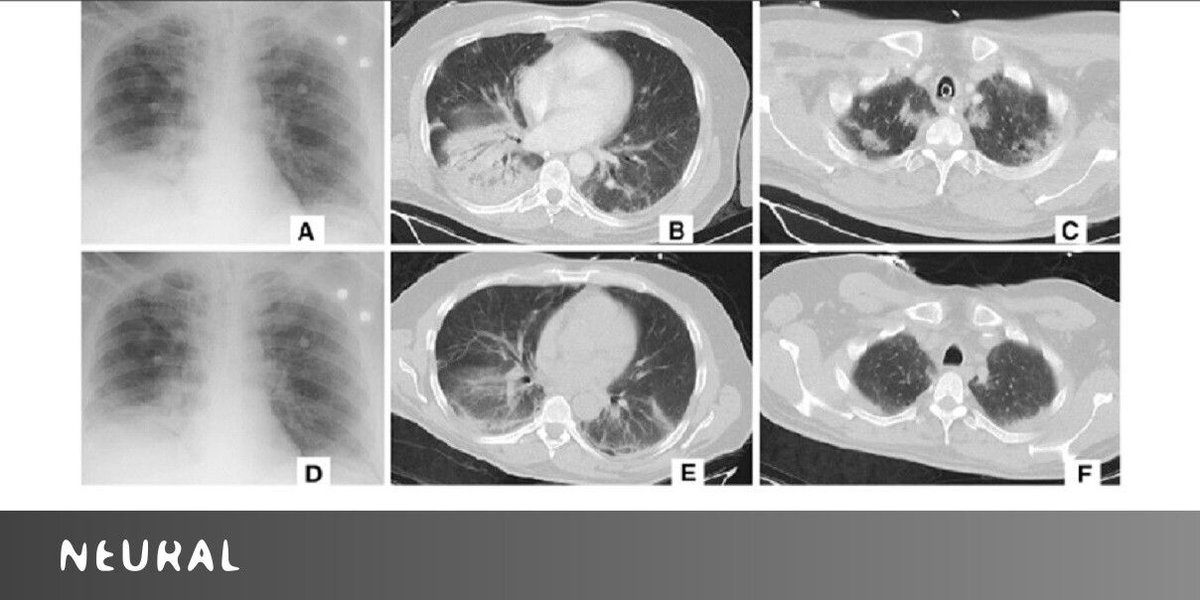 magic_chat's tweet photo. #Alibaba’s new AI system can detect #coronavirus in seconds with 96% accuracy » https://t.co/DNMzj4APvZ via @thenextweb https://t.co/nsfytry5OK