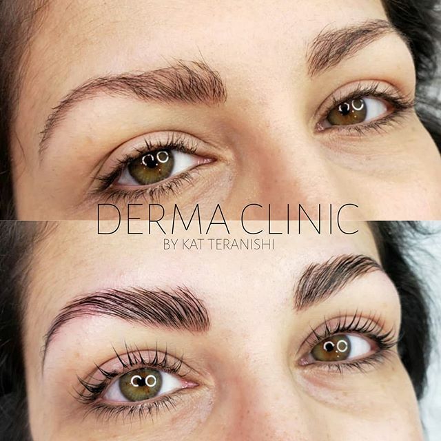 DermaClinicBC's tweet photo. Beautifully lifted brows and lashes. Check out these stunning eyes 🤩
.
.
Brow lamination with tint and lash lift and tint.
Artist: Kat
What's great about this is it's all her own natural hair. We just stuck it in a better position. .

For more info please contact 👇👇👇
.
.… https://t.co/R9pREOdbkR