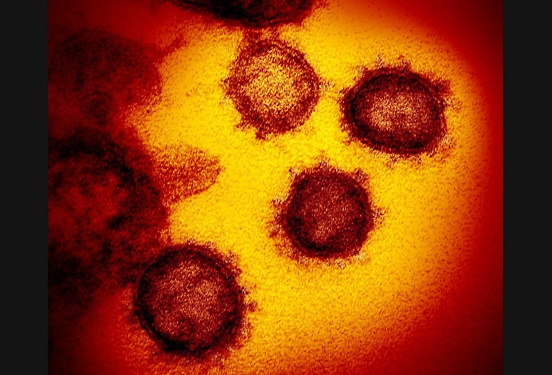 uchile's tweet photo. [ENTREVISTA] Académico @MedicinaUChile Fernando Valiente por llegada de coronavirus COVID-19 a Chile y Latinoamérica: "Por la expansión que está teniendo, es posible que se convierta en pandemia. Sin embargo, no debemos confundir pandemia con letalidad" https://t.co/6TmbeWBBVZ https://t.co/v6XFA3eXPd