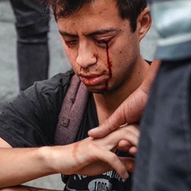 HarryFT0712's tweet photo. Quien disparó a Gustavo Gatica.?
#NoMasImpunidad #BlumelViolaDDHH
#JusticiaParaGustavoGatica
#ChileDesperto https://t.co/GlepVe9Ern