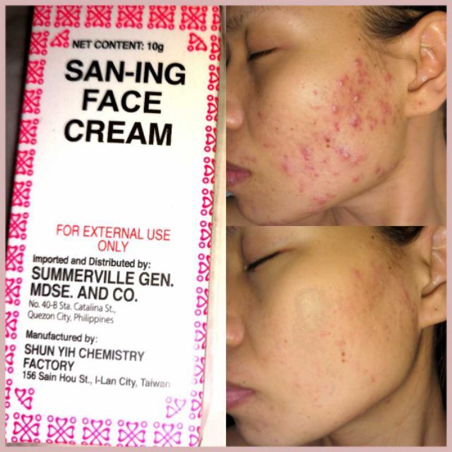 sulfur san ing cream