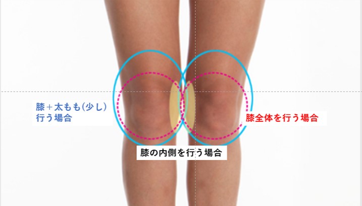 Jsme Clinic Js美クリニック Jongari1004 Twitter