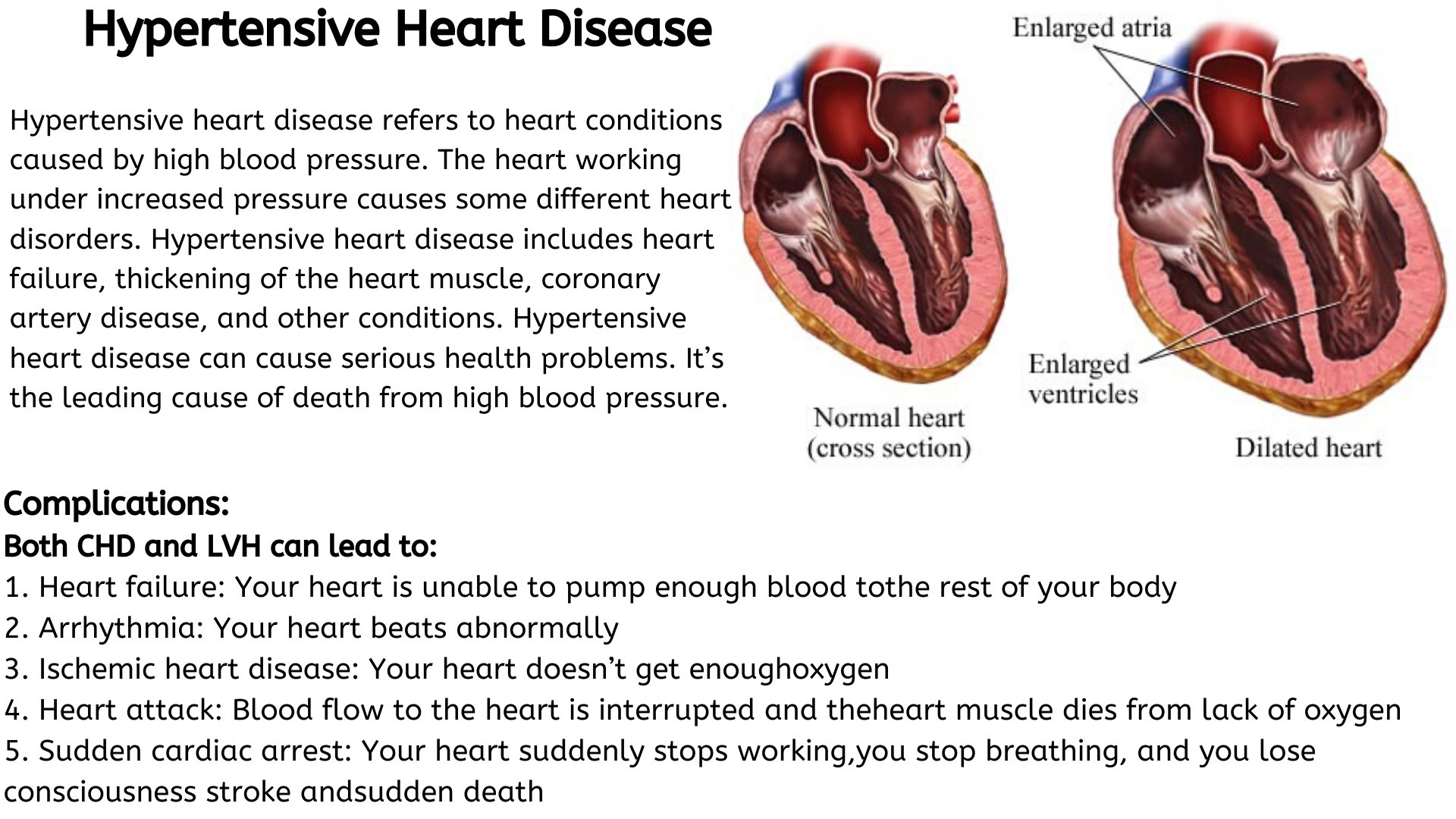 Hypertensive cardiomyopathy deals