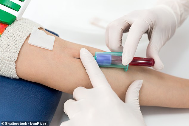 edu4h's tweet photo. Lung cancer a primary cause of death can be detected much earlier with a simple blood test resulting in better outcomes at lower cost
#healthliteracy #healtheducation #hcpsupport #healthtechnology #patienteducation #healthoutcomes #cancer #healthcare
https://t.co/ua6jLj1IyU https://t.co/APmfqHp3NC