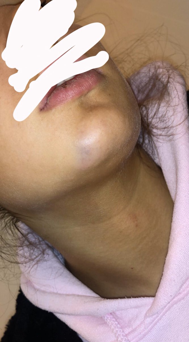 Chloe3Macleod's tweet photo. after some time of thinking i feel like it’s my turn to tell my side of the story. my ex thought it was alright to do this. after being out i was woken to getting started on. i was in no state to fight back! even if i did “cheat” this is disgusting https://t.co/Ryy8Wn1Fyp