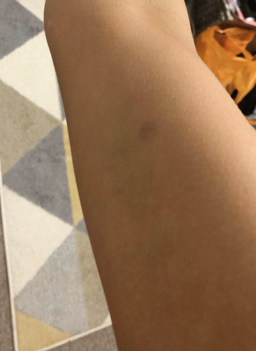 Chloe3Macleod's tweet photo. after some time of thinking i feel like it’s my turn to tell my side of the story. my ex thought it was alright to do this. after being out i was woken to getting started on. i was in no state to fight back! even if i did “cheat” this is disgusting https://t.co/Ryy8Wn1Fyp