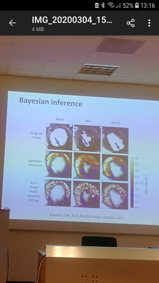 Joukesmink's tweet photo. This week at our annual @PhilipsHealth Application &amp; Clinical Science meeting in Eindhoven we were very fortunate to have @cianmscannell explaining his impressive approach towards quantitative myocardial perfusion https://t.co/wqLaCODZCQ