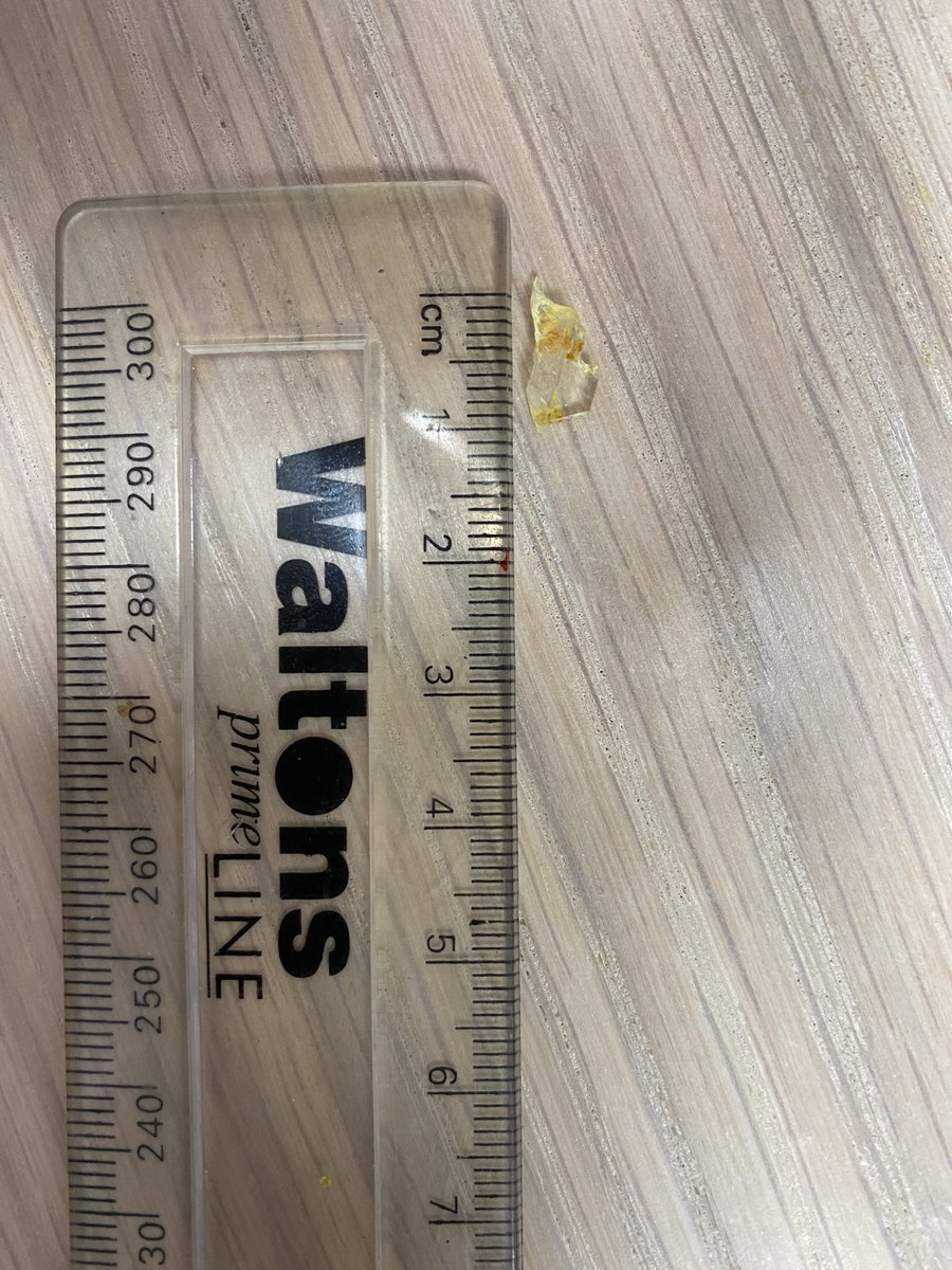 ntolmay's tweet photo. @WOOLWORTHS_SA As a loyal fan this is upsetting and unacceptable to find a sharp piece if glass in my lunch today. How is this possible? I sent a complaint email. #Disappointed https://t.co/isrCSEnNv1