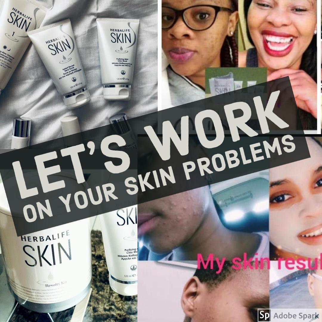 Herbalife Products For Dark Spots Free Shipping