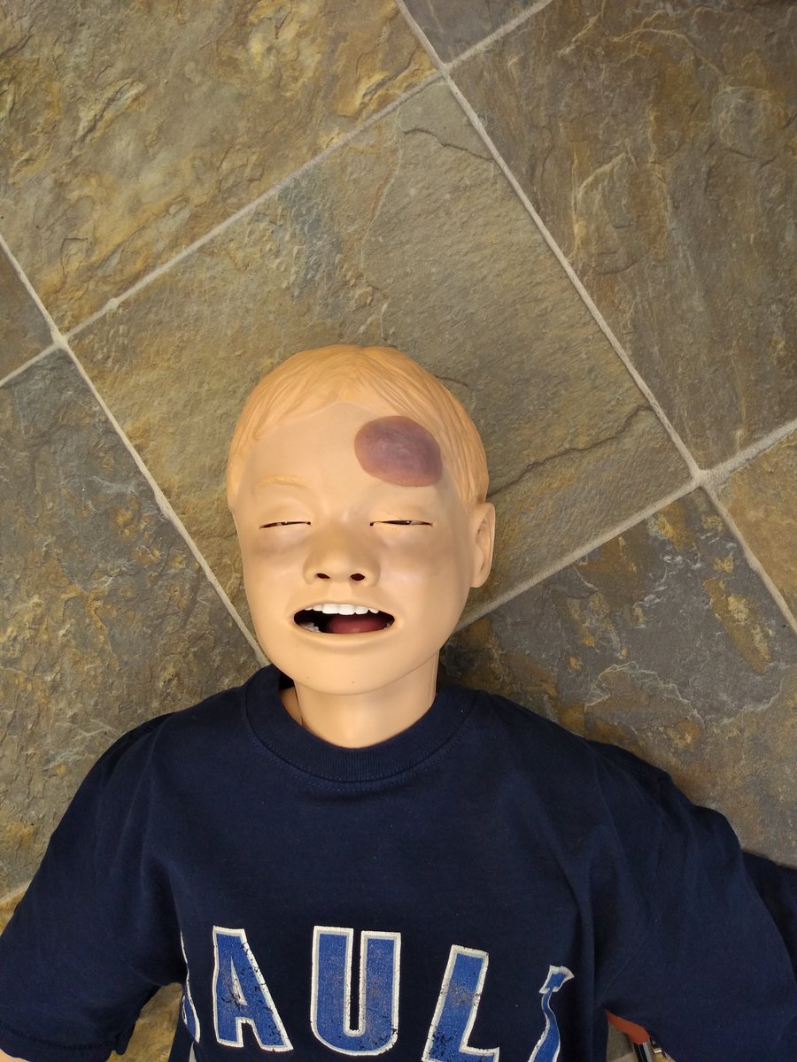 LSSUSuperiorSim's tweet photo. #SimJunior climbed the ladder and lost balance sustaining a Laceration to the back of the head and a Hematoma to the left forehead area. EMED students will assist and transport him to the hospital. #Healthcare, #Learning, #Success, #PatientSafety, #WeAllBelongHere, #Simulation https://t.co/JwRmbl2djC