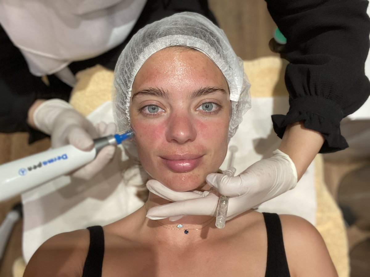 TBSDubai's tweet photo. Testing Out: The Dermapen Mesofacial - https://t.co/FSqCHbo9oo

I never realized just how important getting a facial was, or just how much they can really help your skin. Having trialled different types of facials and deep cleansing treatments, I was yet to come ac... https://t.co/5IgvDheVao