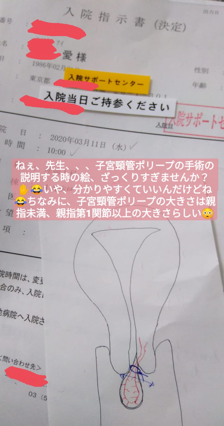 ポリープ 子宮 頚 管
