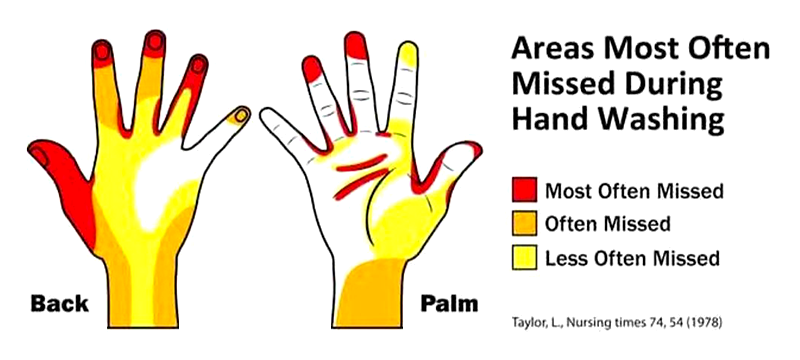 benkshown's tweet photo. #ThrowbackThursday to this nifty data visualization/illustration from 1978 on areas most often missed during hand washing #washyourhandslike #tbt #coronavirus #covid19 https://t.co/vfygPrShF1 https://t.co/mMTNy0yTuX