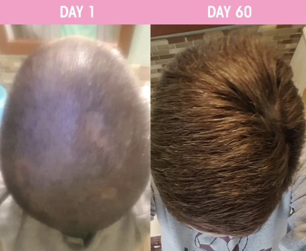 STTROPICA's tweet photo. Swipe for INCREDIBLE results! 😍
#customerreview #realcustomerresults #hairgrowth #60dayhairchallenge #hairgrowthvitamins #gorgeoushair #hairgoals #longhairdontcare #productsthatwork #productsyoucantrust #sttropica #sttropicaproducts https://t.co/H4eaCvBgho