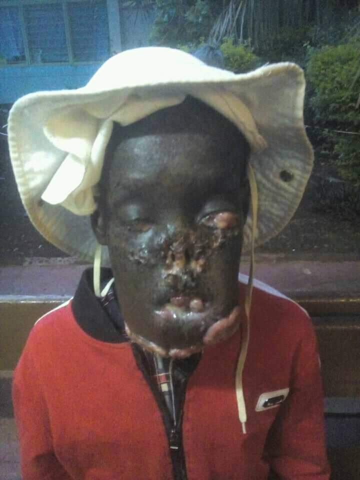Bro <a href="/OmbetaC/">COmbeta</a> ,I have seen you do a great job here...

Kindly help this boy suffering from Skin Cancer get Treatment.

He's from Kihoya,Kangema Muranga County.

Hii ndio number ya Mama yake 0790887486-Jane Muikari Maina.

#KOT can also do something.

😰😰