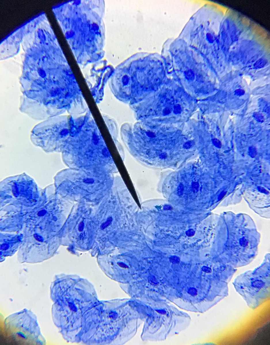 PepScienceSpot's tweet photo. Students had a blast exploring plant cells (Elodea Leaf) and animal cells (human epithelial cells from the inside of their cheeks) Note the cell walls, green chloroplasts and the blue nucleus. #Bermbuzz #biology #Grade9Science #ILoveScience https://t.co/u3bM9QaEOd