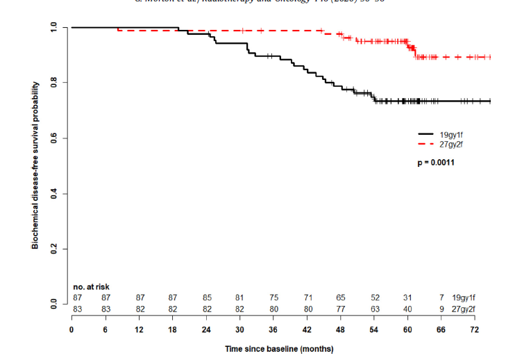 DrAndrewLoblaw's tweet photo. For those of you waiting with baited breath for @gerard_morton @Sunnybrook #HDRmono RCT, here's the free link to the article @ELS_Oncology #GreenJ
Putting all the data together, single fraction HDR is insufficient treatment for #prostatecancer
https://t.co/bUXDcdY7ov https://t.co/kpNQ0tnjOK