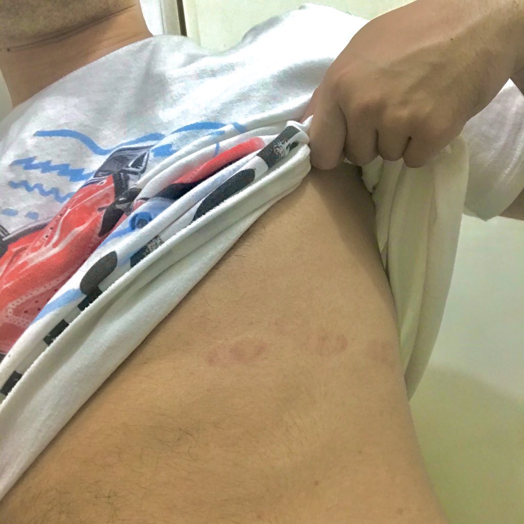 ned_neddd's tweet photo. Kunwari may jowa....pero sa totoo nag electrocardiogram lang 🤘🏻

#ReturnDemo #NurseProbz https://t.co/ch7MtqV0mP