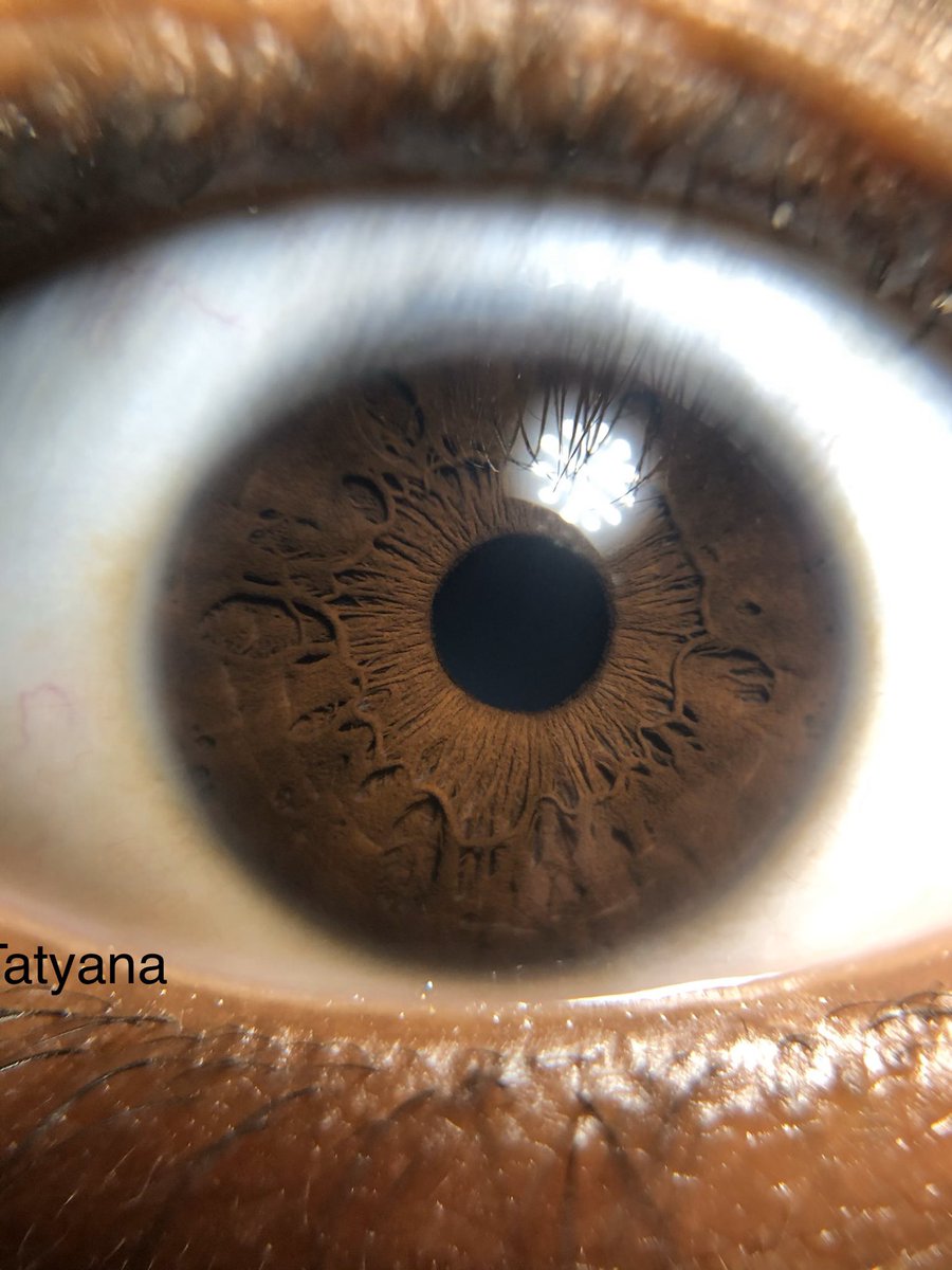 CMacBiology's tweet photo. MacroPhotography and Genetics... 😍 Today, the brown eyes have it 👏🏼👌🏼 @SalemHSVB @cindyqb @LeeaneTurnbull @jknightshs @MatthewDelaney9 https://t.co/KiQTBDGDbj